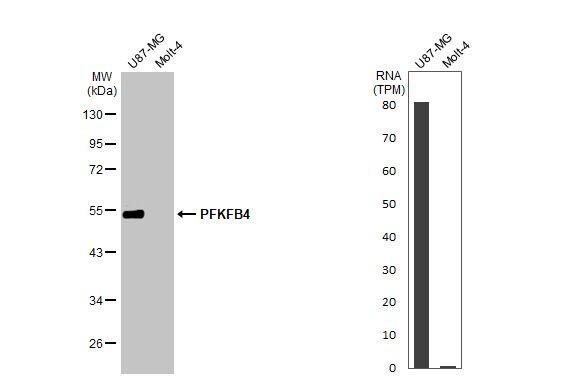 PFKFB4 Antibody in Western Blot (WB)