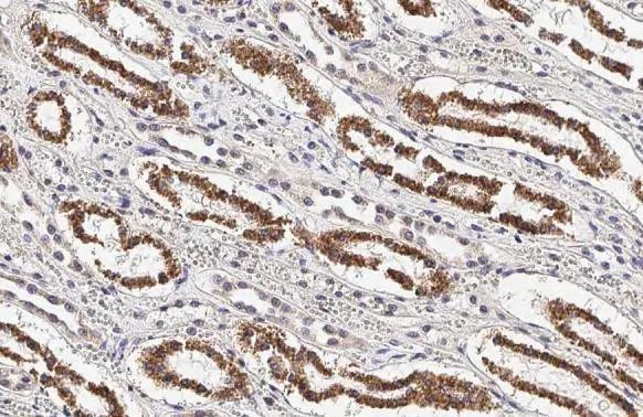 Cytochrome C Antibody in Immunohistochemistry (Paraffin) (IHC (P))