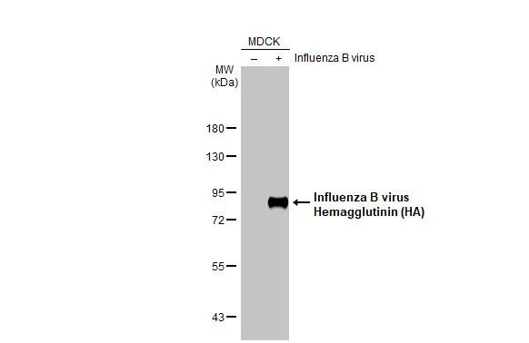 Influenza B virus (B/Taiwan/753/2005) (Yamagata) Antibody in Western Blot (WB)