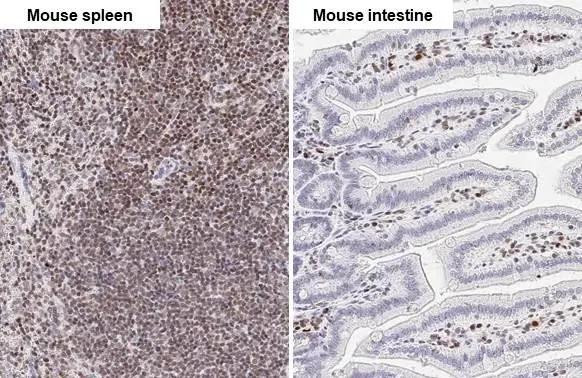 RUNX1 Antibody in Immunohistochemistry (Paraffin) (IHC (P))