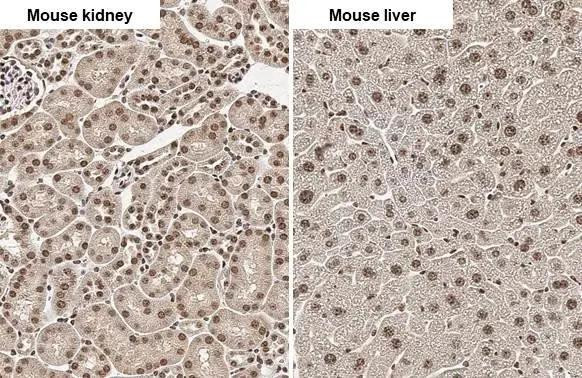 Angiogenin Antibody in Immunohistochemistry (Paraffin) (IHC (P))