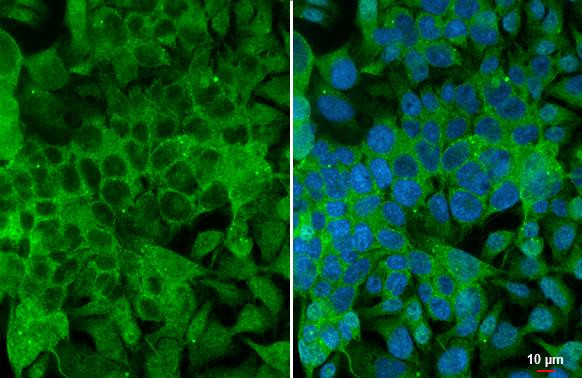 Angiogenin Antibody in Immunocytochemistry (ICC/IF)