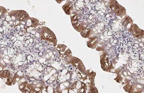 mTOR Antibody in Immunohistochemistry (Paraffin) (IHC (P))