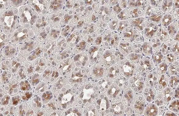 FN3K Antibody in Immunohistochemistry (Paraffin) (IHC (P))