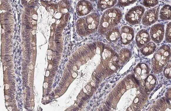 FN3K Antibody in Immunohistochemistry (Paraffin) (IHC (P))