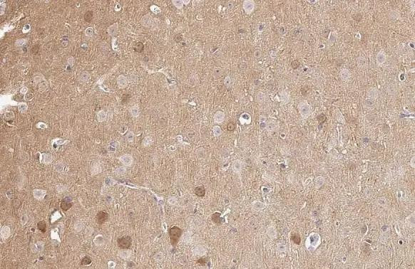 PKC gamma Antibody in Immunohistochemistry (Paraffin) (IHC (P))