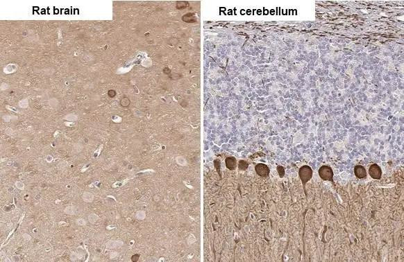 PKC gamma Antibody in Immunohistochemistry (Paraffin) (IHC (P))