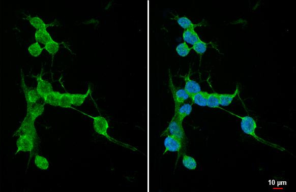 PKC gamma Antibody in Immunocytochemistry (ICC/IF)