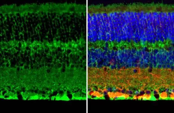 S100B Antibody in Immunohistochemistry (Paraffin) (IHC (P))