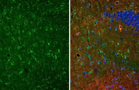 S100B Antibody in Immunohistochemistry (Paraffin) (IHC (P))