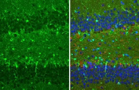 S100B Antibody in Immunohistochemistry (Paraffin) (IHC (P))