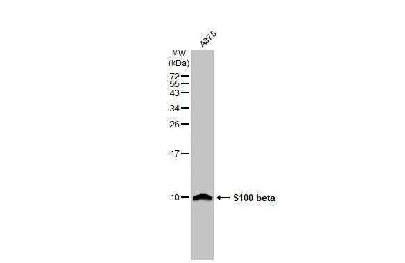 S100B Antibody in Western Blot (WB)