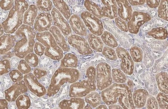 SLC27A2 Antibody in Immunohistochemistry (Paraffin) (IHC (P))