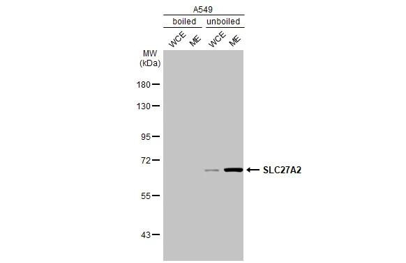 SLC27A2 Antibody in Western Blot (WB)