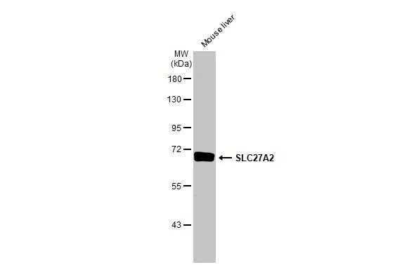 SLC27A2 Antibody in Western Blot (WB)