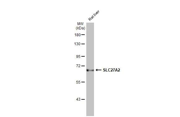 SLC27A2 Antibody in Western Blot (WB)