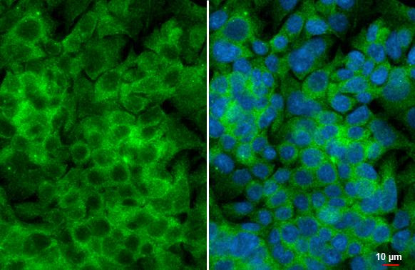 YTHDF3 Antibody in Immunocytochemistry (ICC/IF)