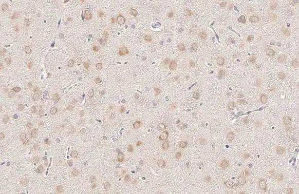 YTHDF3 Antibody in Immunohistochemistry (Paraffin) (IHC (P))