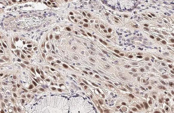 p53 Antibody in Immunohistochemistry (Paraffin) (IHC (P))