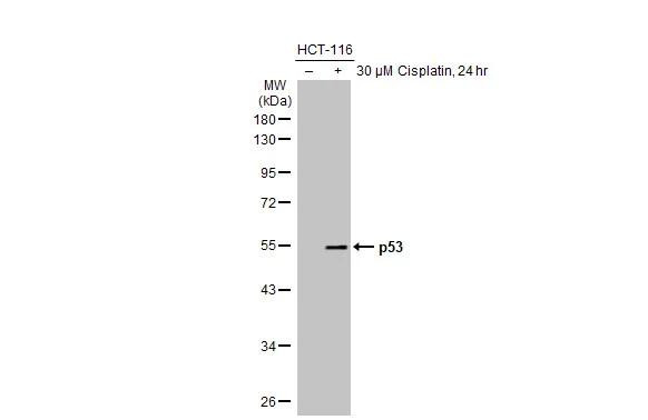 p53 Antibody in Western Blot (WB)