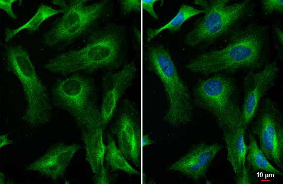 RIP1 Antibody in Immunocytochemistry (ICC/IF)