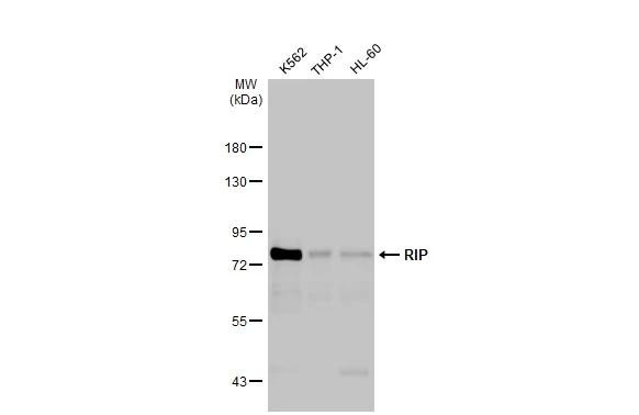 RIP1 Antibody in Western Blot (WB)