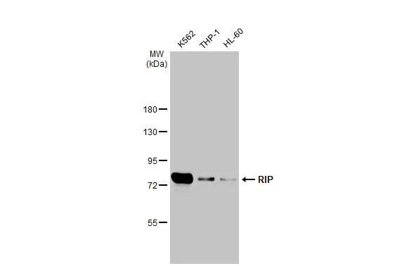 RIP1 Antibody in Western Blot (WB)