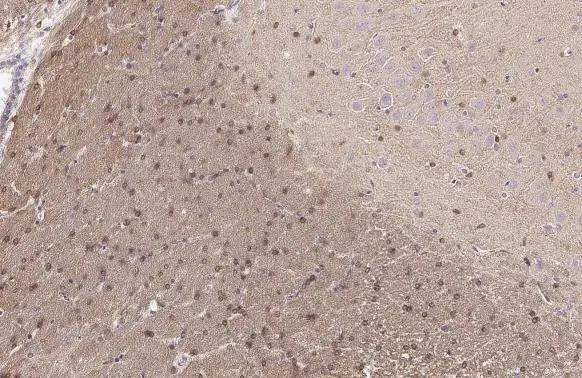 G3BP1 Antibody in Immunohistochemistry (Paraffin) (IHC (P))