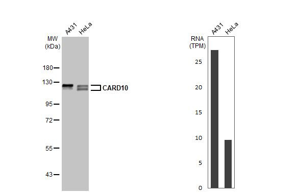 CARD10 Antibody in Western Blot (WB)