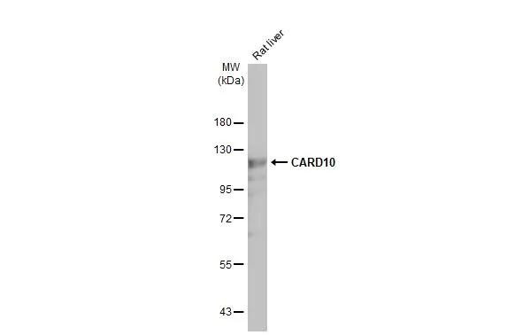 CARD10 Antibody in Western Blot (WB)