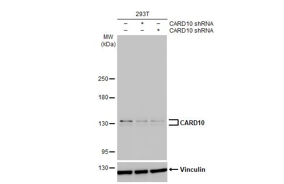 CARD10 Antibody in Western Blot (WB)