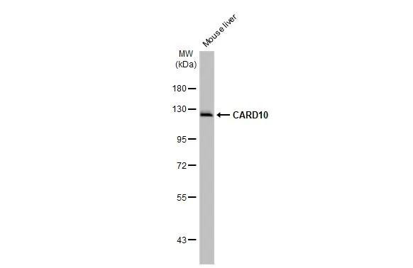 CARD10 Antibody in Western Blot (WB)