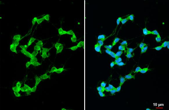 Stargazin Antibody in Immunocytochemistry (ICC/IF)