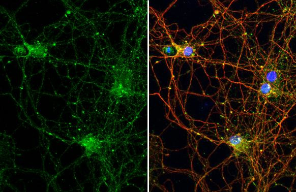 Stargazin Antibody in Immunocytochemistry (ICC/IF)