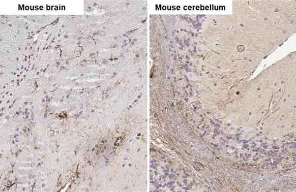 Stargazin Antibody in Immunohistochemistry (Paraffin) (IHC (P))