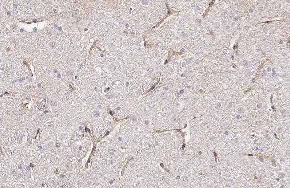 Stargazin Antibody in Immunohistochemistry (Paraffin) (IHC (P))