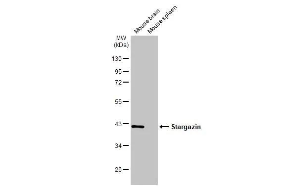 Stargazin Antibody in Western Blot (WB)