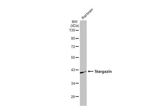 Stargazin Antibody in Western Blot (WB)