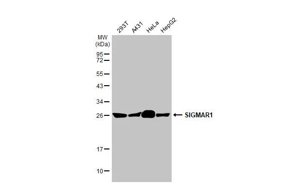 Sigma-1 Receptor Antibody in Western Blot (WB)