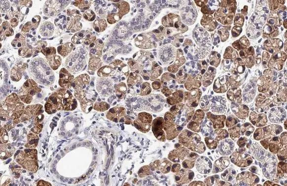 GPS2 Antibody in Immunohistochemistry (Paraffin) (IHC (P))