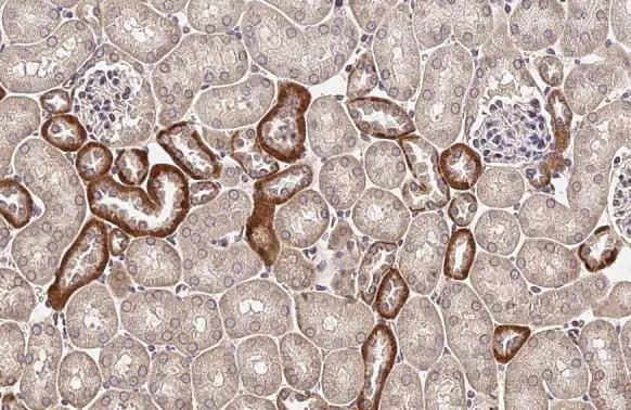 TMPRSS2 Antibody in Immunohistochemistry (Paraffin) (IHC (P))