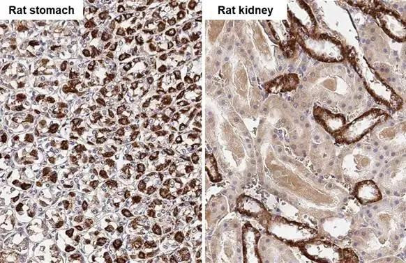 TMPRSS2 Antibody in Immunohistochemistry (Paraffin) (IHC (P))