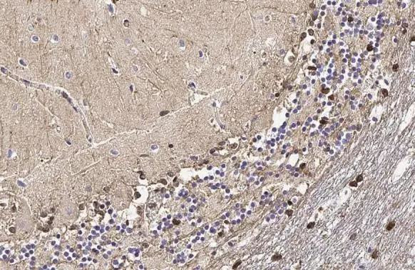 Glutamine Synthetase Antibody in Immunohistochemistry (Paraffin) (IHC (P))