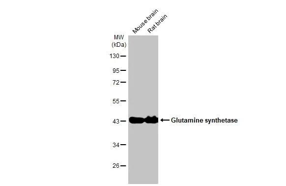 Glutamine Synthetase Antibody in Western Blot (WB)