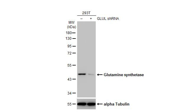 Glutamine Synthetase Antibody in Western Blot (WB)