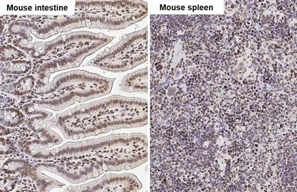 UHRF1 Antibody in Immunohistochemistry (Paraffin) (IHC (P))