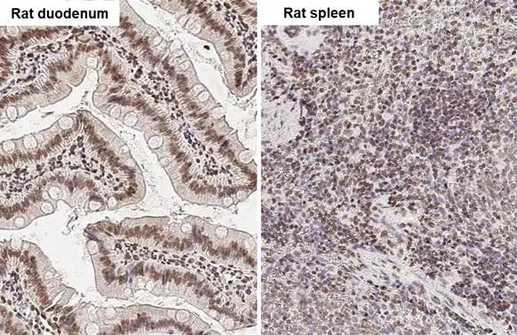 UHRF1 Antibody in Immunohistochemistry (Paraffin) (IHC (P))