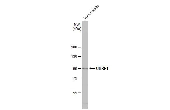 UHRF1 Antibody in Western Blot (WB)