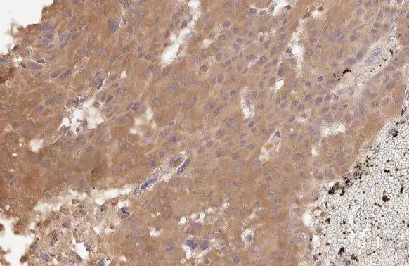 VEGFC Antibody in Immunohistochemistry (Paraffin) (IHC (P))