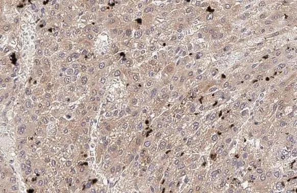 VEGFC Antibody in Immunohistochemistry (Paraffin) (IHC (P))